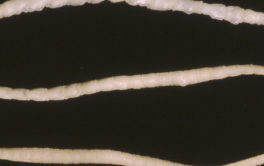 Cats can be infected by species of tapeworms that grow up to 15 feet